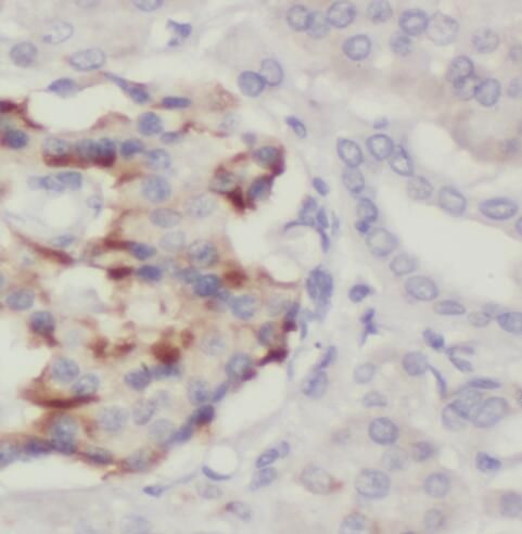 PTPN4 Antibody - BSA Free