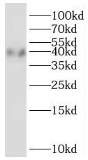 ZADH1 Antibody - BSA Free