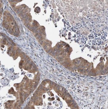 PTER Antibody - BSA Free
