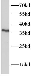 PSTPIP2 Antibody - BSA Free