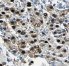 PSME4 Antibody - BSA Free