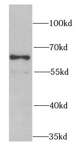 Proteasome 19S S3 Antibody - BSA Free