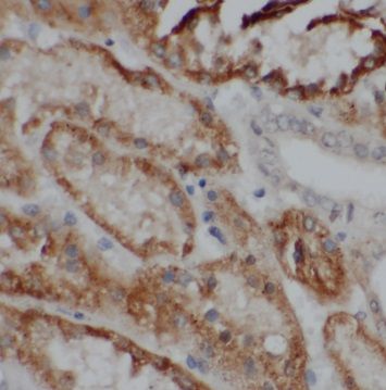 PSKH2 Antibody - BSA Free