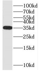 PSKH2 Antibody - BSA Free