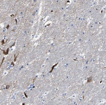Pregnancy specific beta 1 glycoprotein 11 Antibody - BSA Free