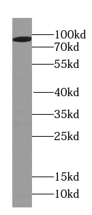 PSD2 Antibody - BSA Free