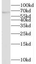 PRR14 Antibody - BSA Free