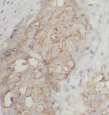 PRR13 Antibody - BSA Free