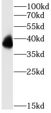 Peripherin 2/PRPH2 Antibody - BSA Free