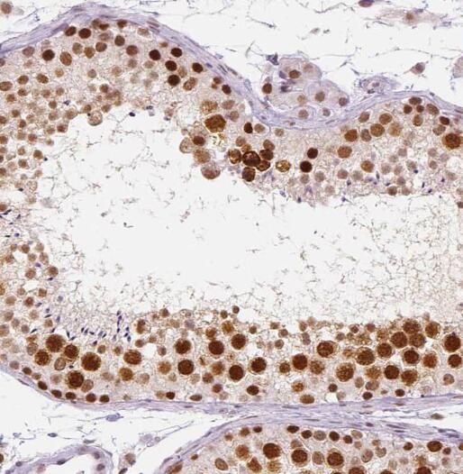 PRPF6 Antibody - BSA Free