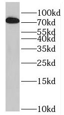PRPF39 Antibody - BSA Free