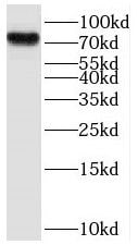 ProSAPiP1 Antibody - BSA Free