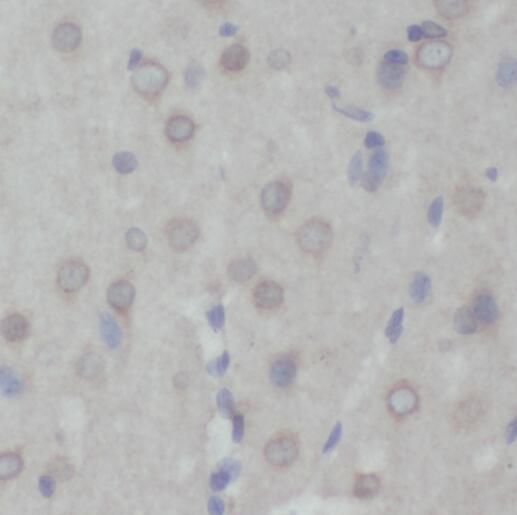 PRMT8 Antibody - BSA Free