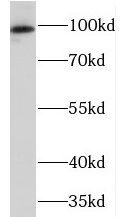 Protein Kinase D2 Antibody - BSA Free