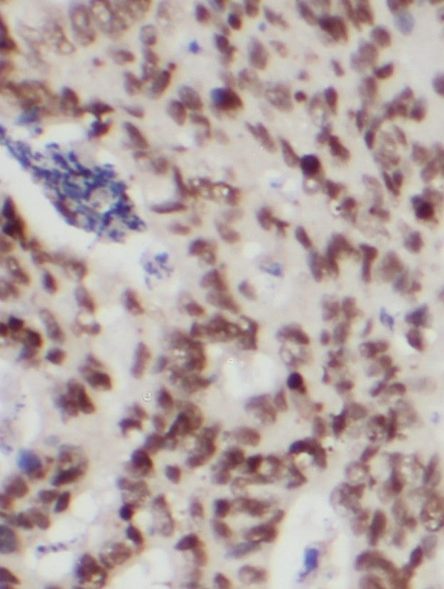 Protein Kinase D2 Antibody - BSA Free