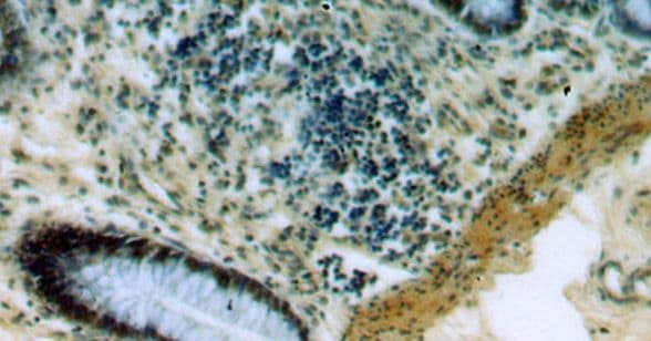 PRICKLE3 Antibody - BSA Free