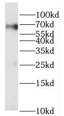 PRCC Antibody - BSA Free