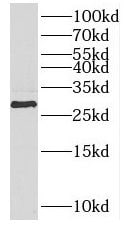 PPT2 Antibody - BSA Free