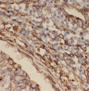 PPPDE1 Antibody - BSA Free