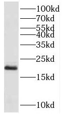 PPP3R2 Antibody - BSA Free