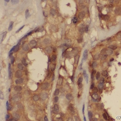 PPP2R2C Antibody - BSA Free