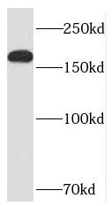 Neurabin 1 Antibody - BSA Free