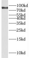 PPP1R3F Antibody - BSA Free