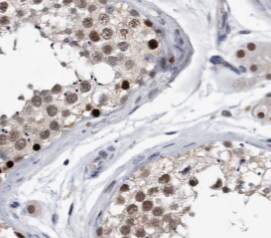 PPP1R2P9 Antibody - BSA Free