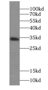 PPP1R2P9 Antibody - BSA Free