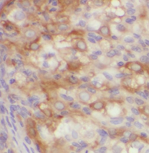 PPP1R15B Antibody - BSA Free