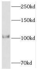 PPP1R15B Antibody - BSA Free