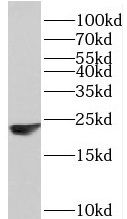 PPP1R14B Antibody - BSA Free