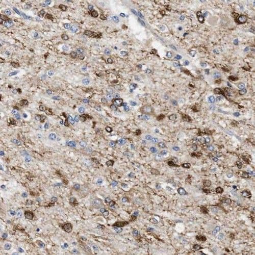 PPM1K Antibody - BSA Free