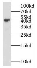 PPM1K Antibody - BSA Free