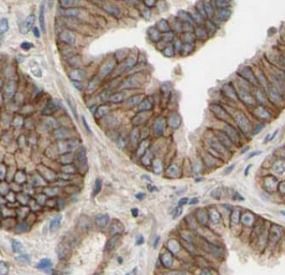POTED Antibody - BSA Free