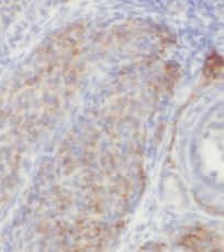 POTEA Antibody - BSA Free