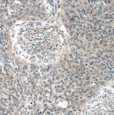 POM121 Antibody - BSA Free