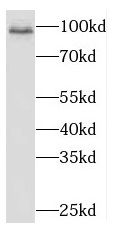 NARG1L Antibody - BSA Free