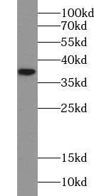 N-Acetyl-D-Glucosamine Kinase/NAGK Antibody - BSA Free
