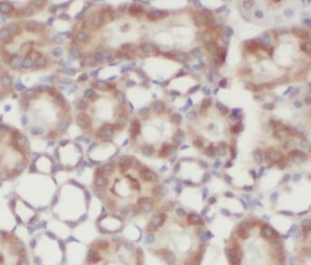 N-Acetyl-D-Glucosamine Kinase/NAGK Antibody - BSA Free