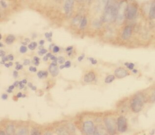 SSNA1 Antibody - BSA Free