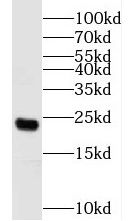 HEMK2 Antibody - BSA Free