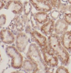 N4BP3 Antibody - BSA Free