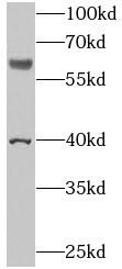 N4BP3 Antibody - BSA Free