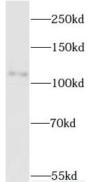 MYT1L Antibody - BSA Free