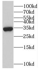 myozenin 3 Antibody - BSA Free