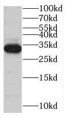 Myozenin 1 Antibody - BSA Free
