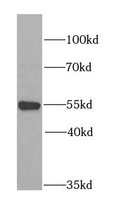 Myotilin Antibody - BSA Free