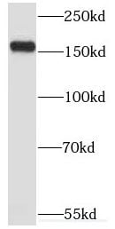 MYOM3 Antibody - BSA Free