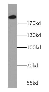 MYOM1 Antibody - BSA Free
